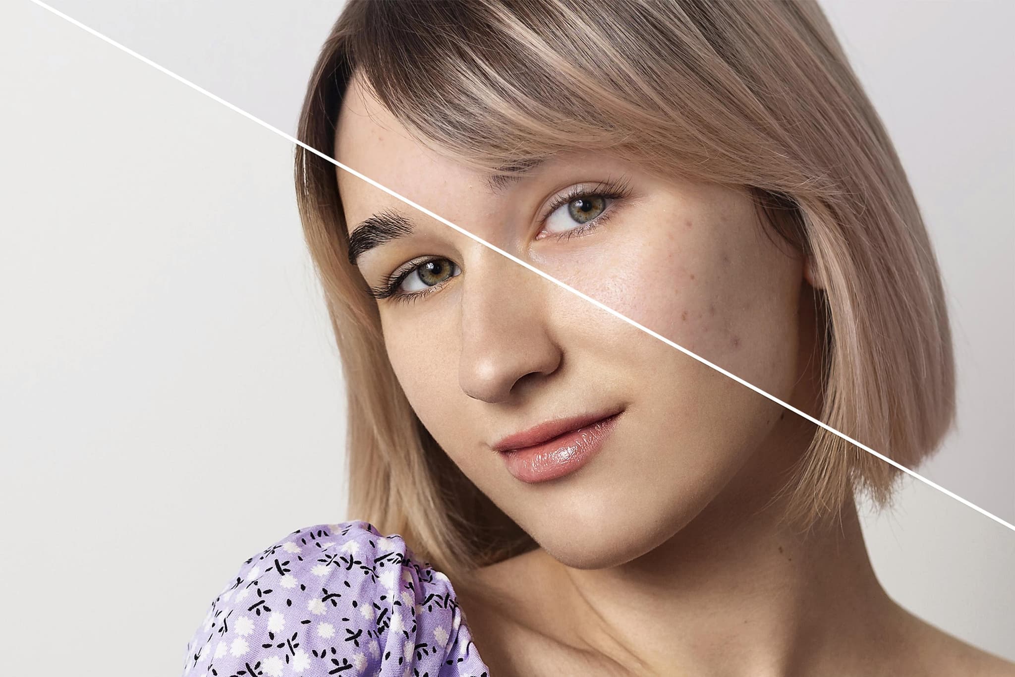 Skin Boosters