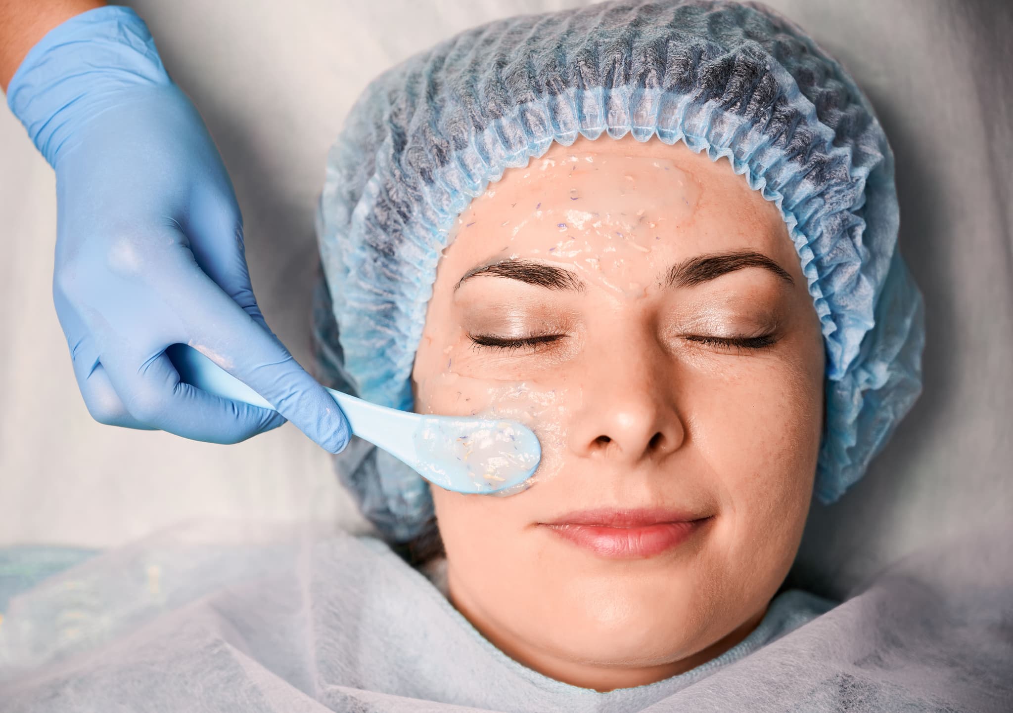 Skin Peeling & Medical Facials