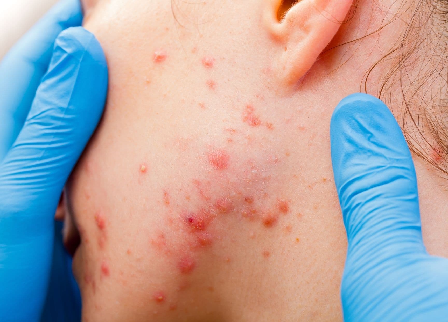Skin Disease Consultation